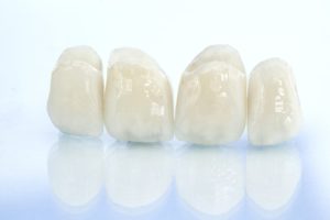 close up of dental crowns