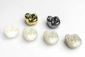 types of dental crowns on a white background