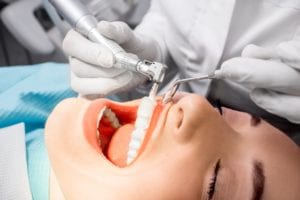 woman having her teeth cleaned