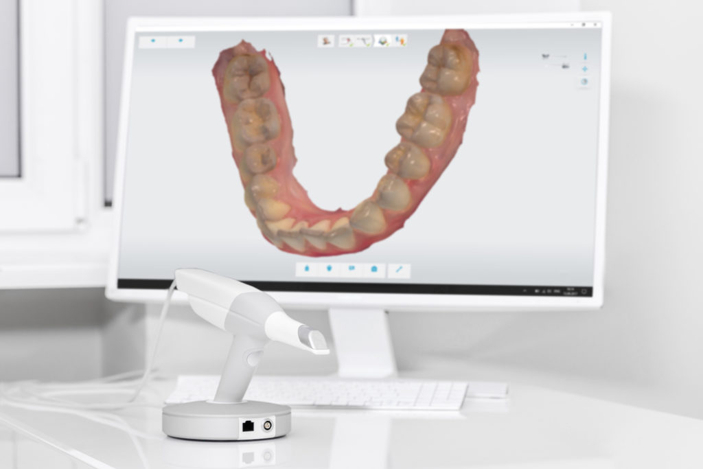 teeth impression being digitally made