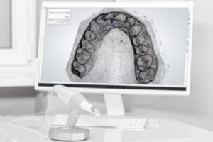 3D Printer for Dental practice