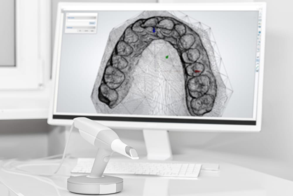 3D Printer for Dental practice
