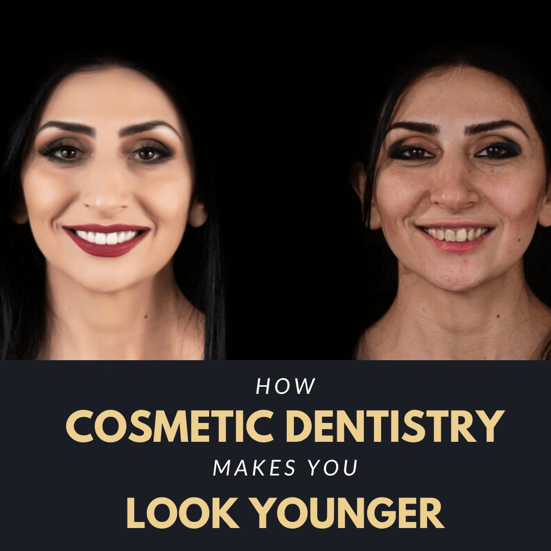 How-Cosmetic-Dentistry-Makes-You-Look-Yo