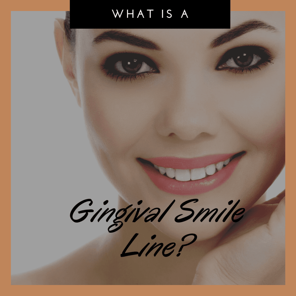 What is a Gingival Smile Line