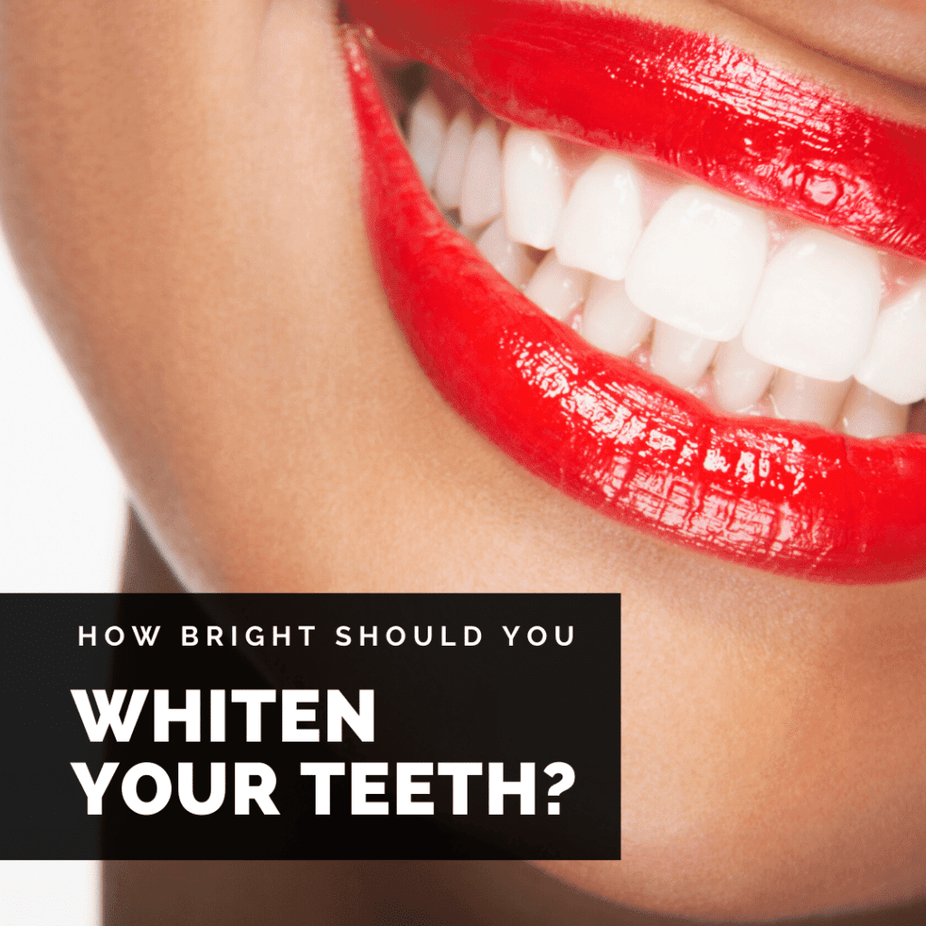 how bright should you whiten your teeth
