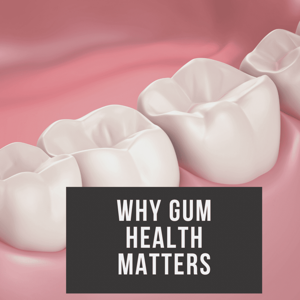 Why Gum Health Matters