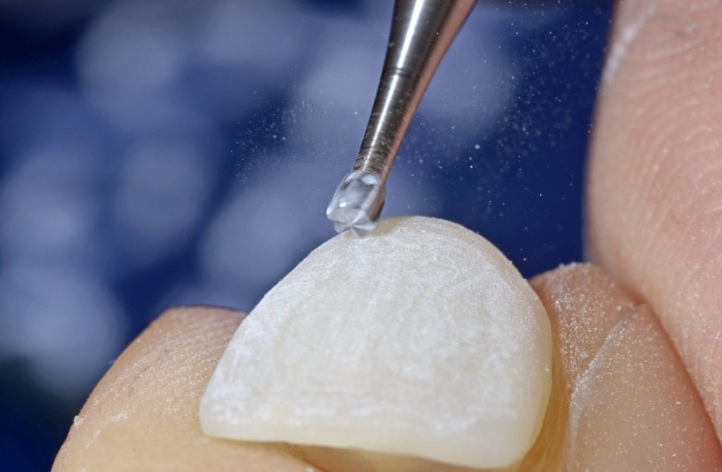 dental crown being polished