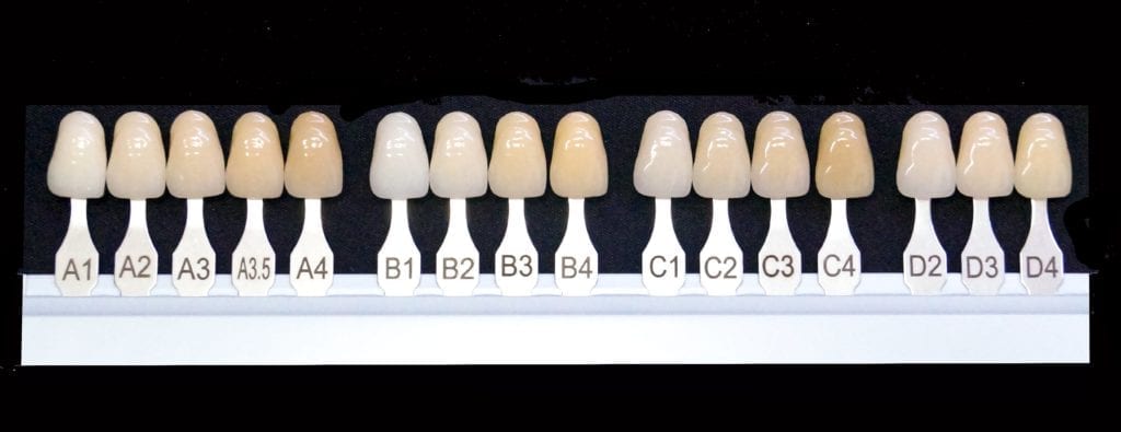 natural shade guide for teeth