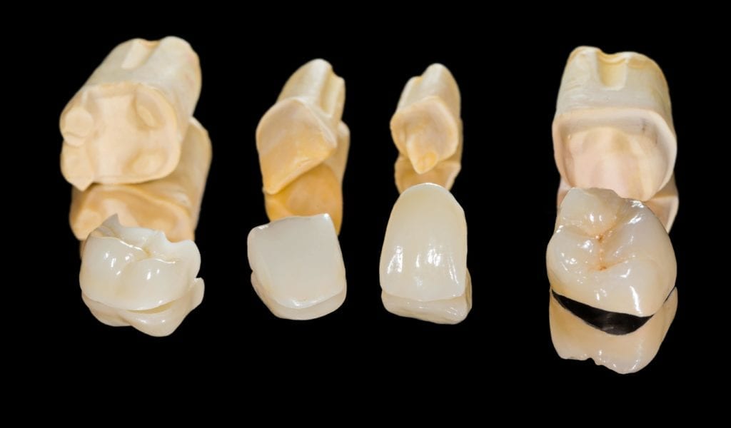various permanent dental restorations