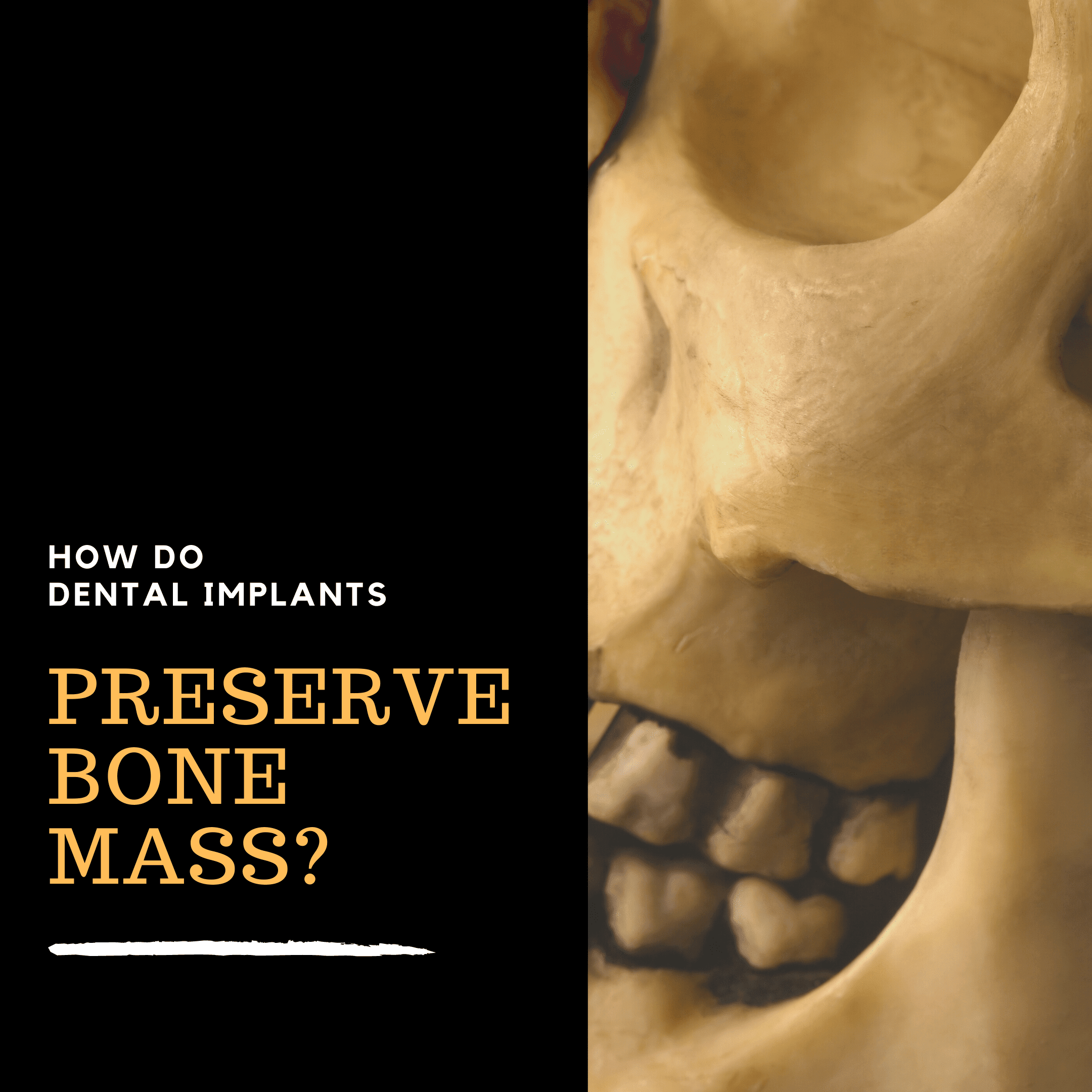 How Do Dental Implants Preserve Bone Mass? Empire Dental