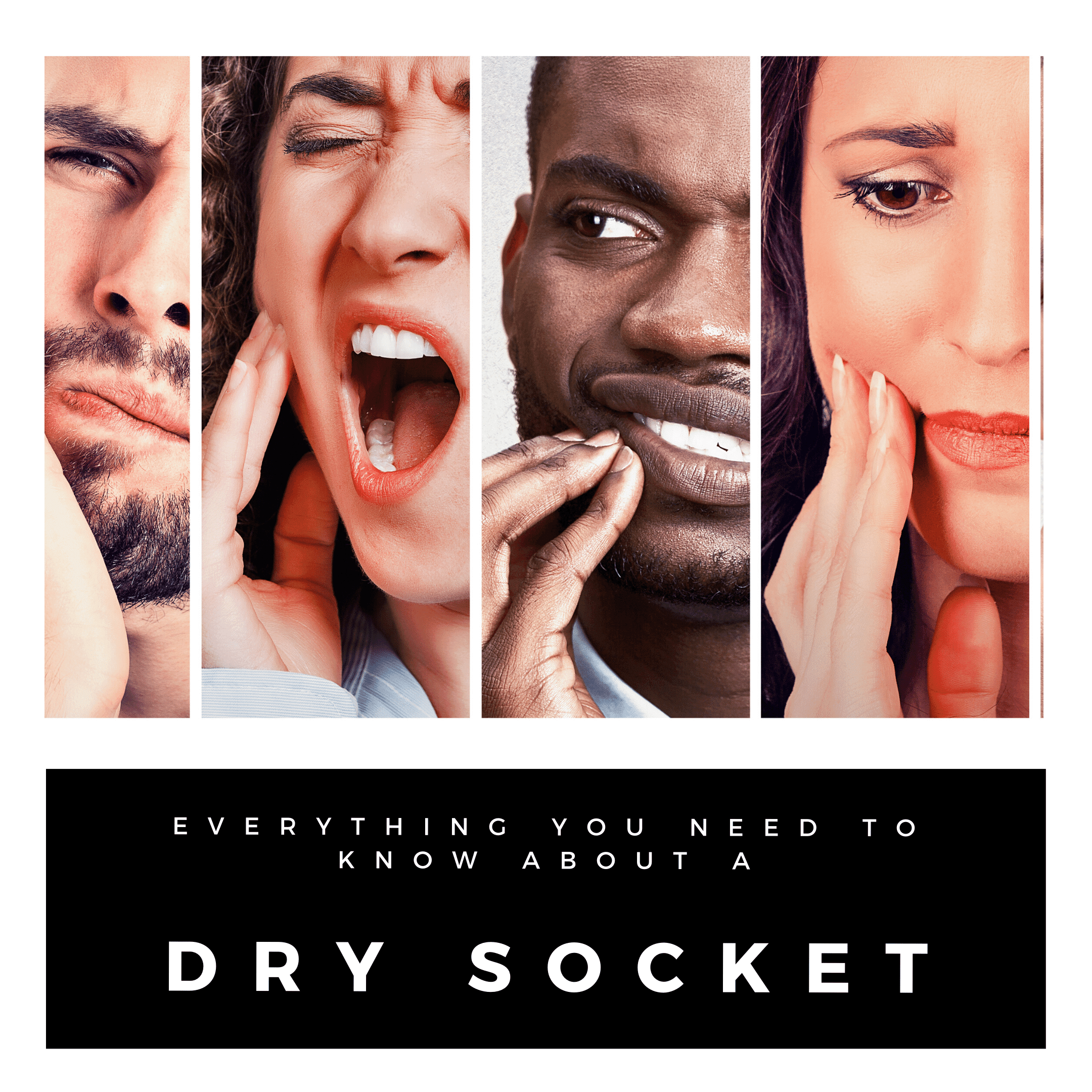 A Dry Socket - What is it, why does it happen, and how is it treated?
