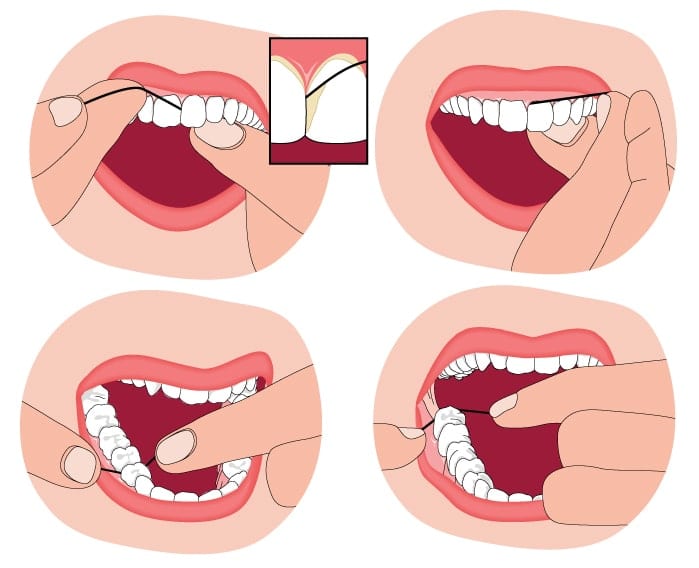 diagram showing places to floss