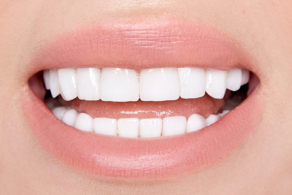 smile with veneers