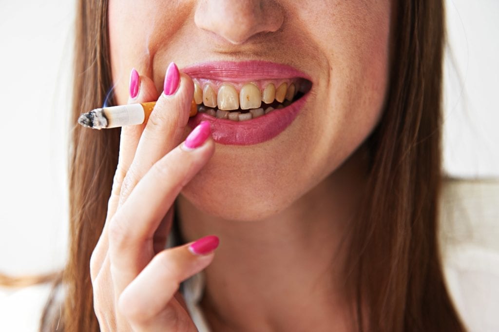 woman with brown teeth smoking a cigarette 