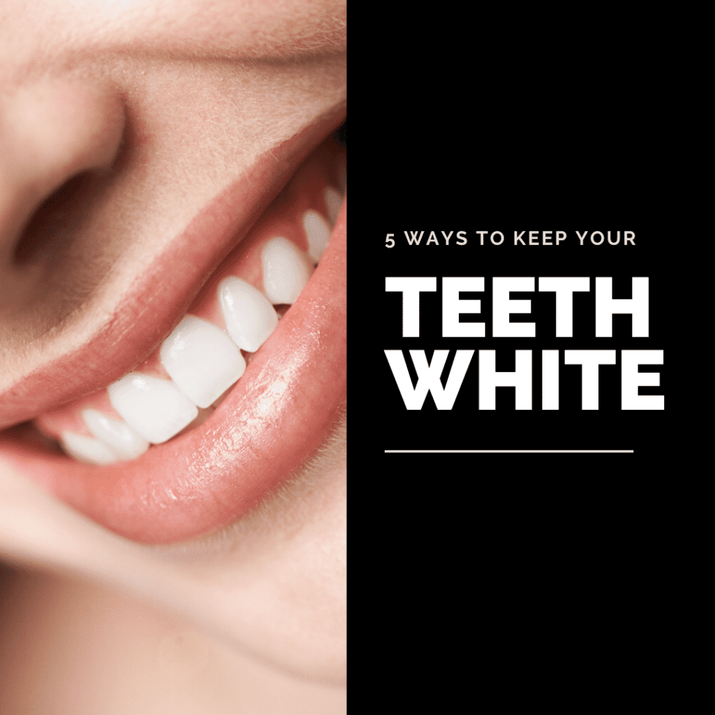How to Keep Your Teeth White2