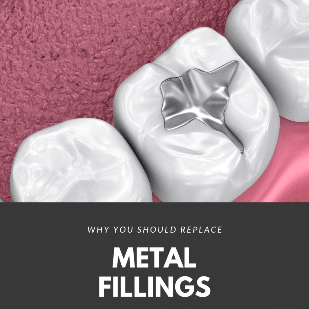 Why You Should Replace Metal Fillings