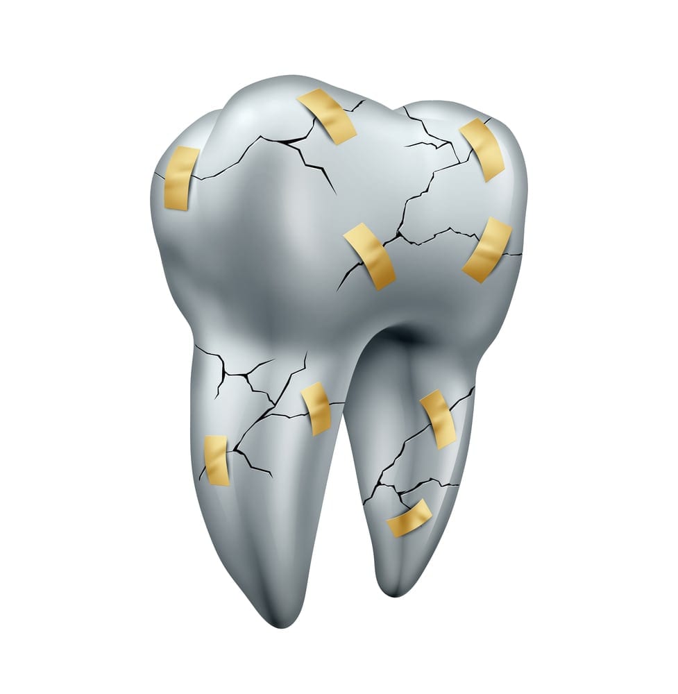 broken tooth held together with tape