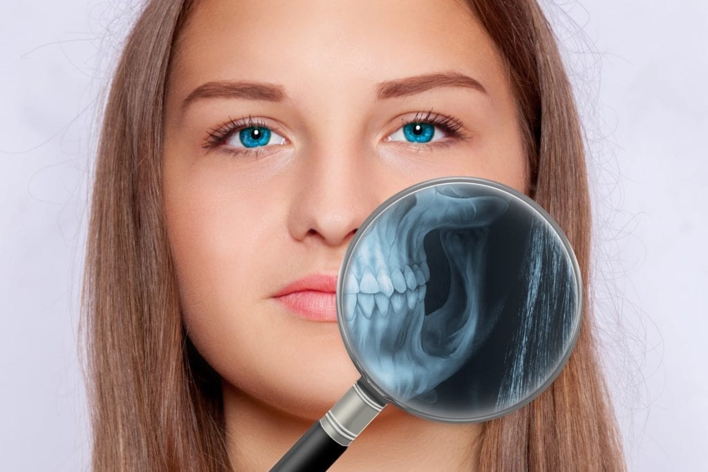 woman's face with a magnifying glass showing an x-ray of her jaw on one side