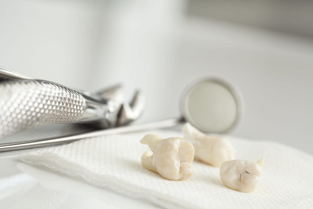 extracted teeth on gauze beside a dental mirror and forceps