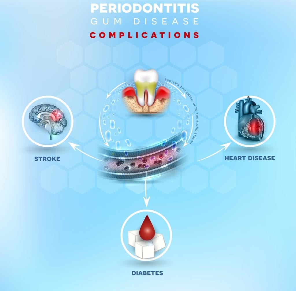 gum disease complications
