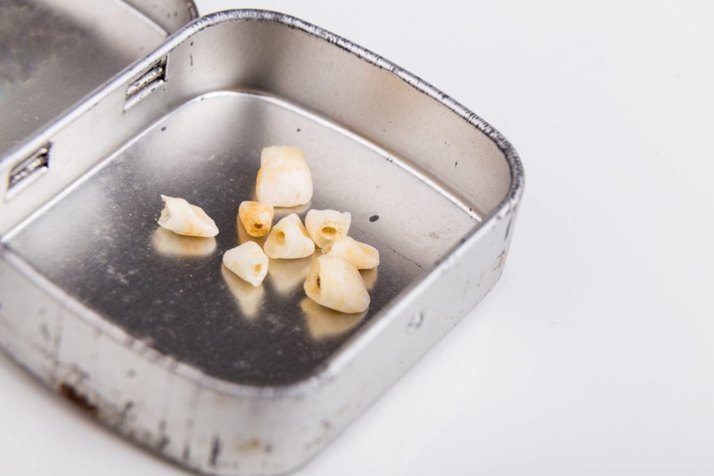 small metal tin with missing teeth
