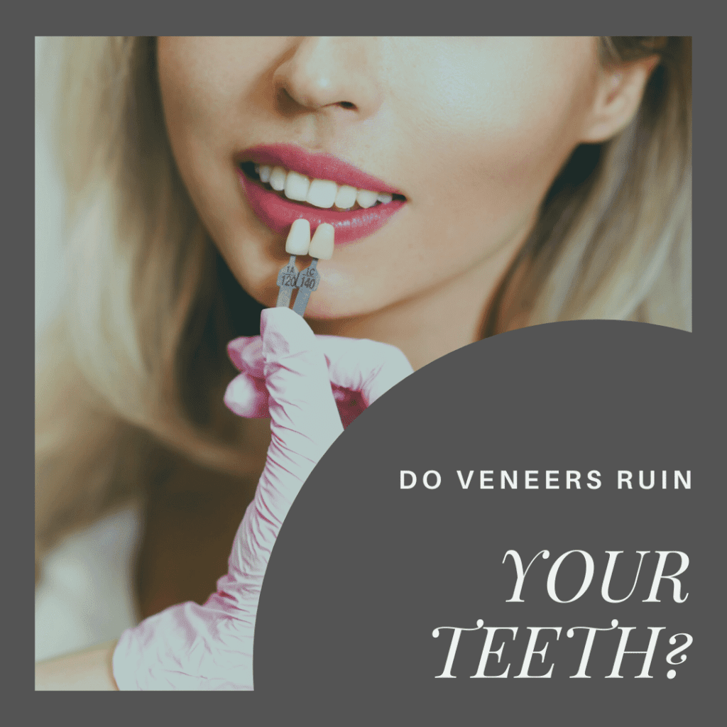 Do Veneers Ruin your teeth