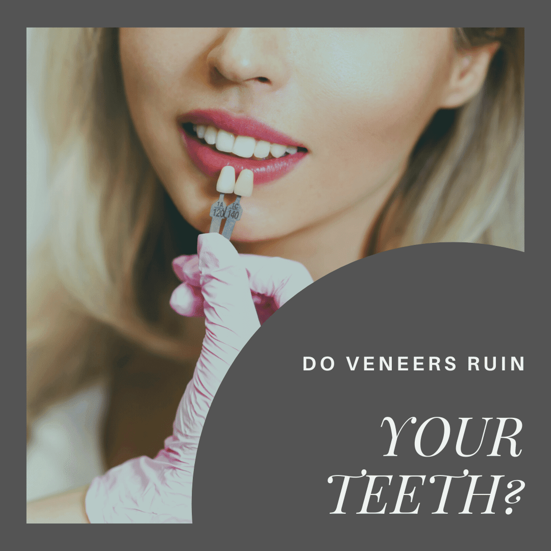 Do Veneers Ruin Your Teeth? Empire Dental