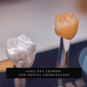 Same Day Crowns for Dental Emergencies