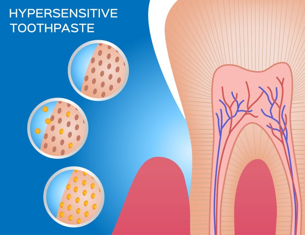 Desensitizing Toothpaste