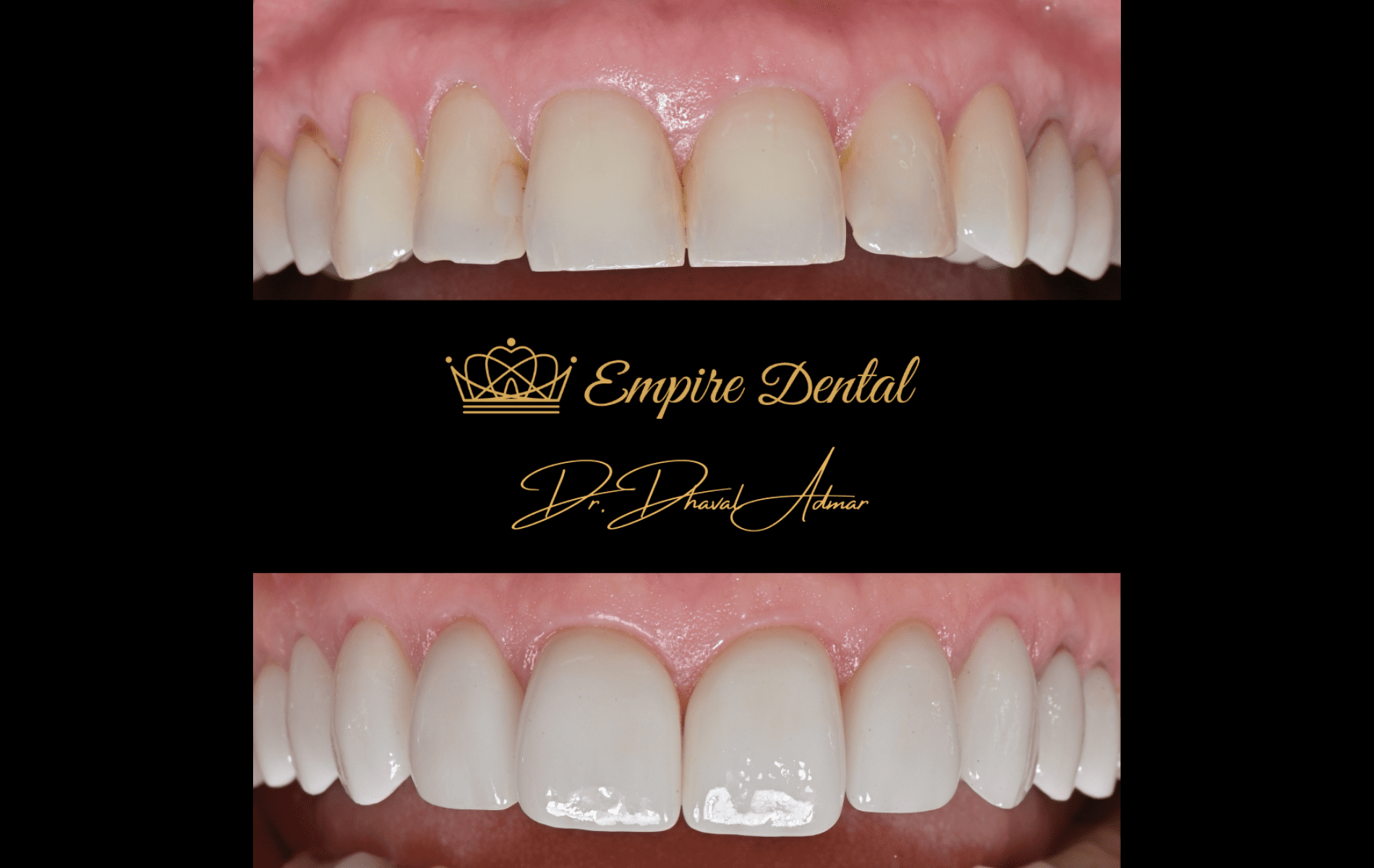 Empire Dental before and after (5)