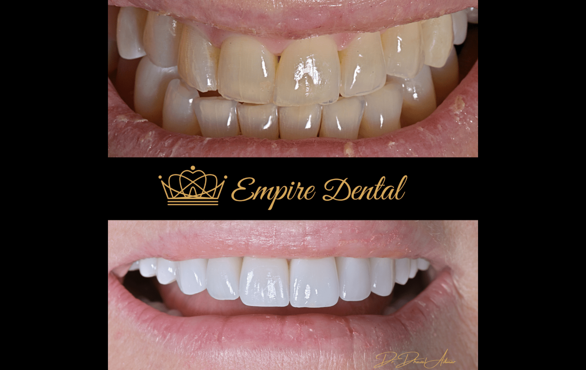 Empire Dental before and after