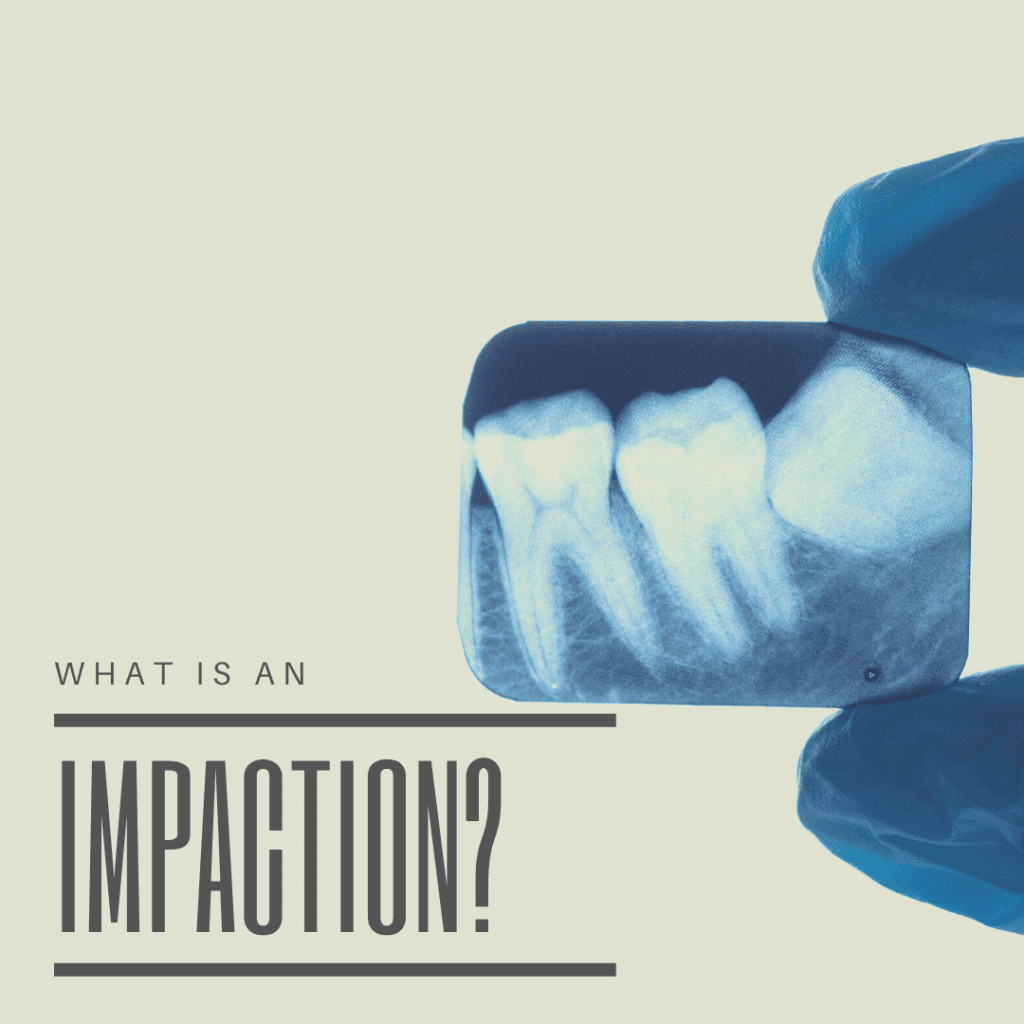 What is an impaction