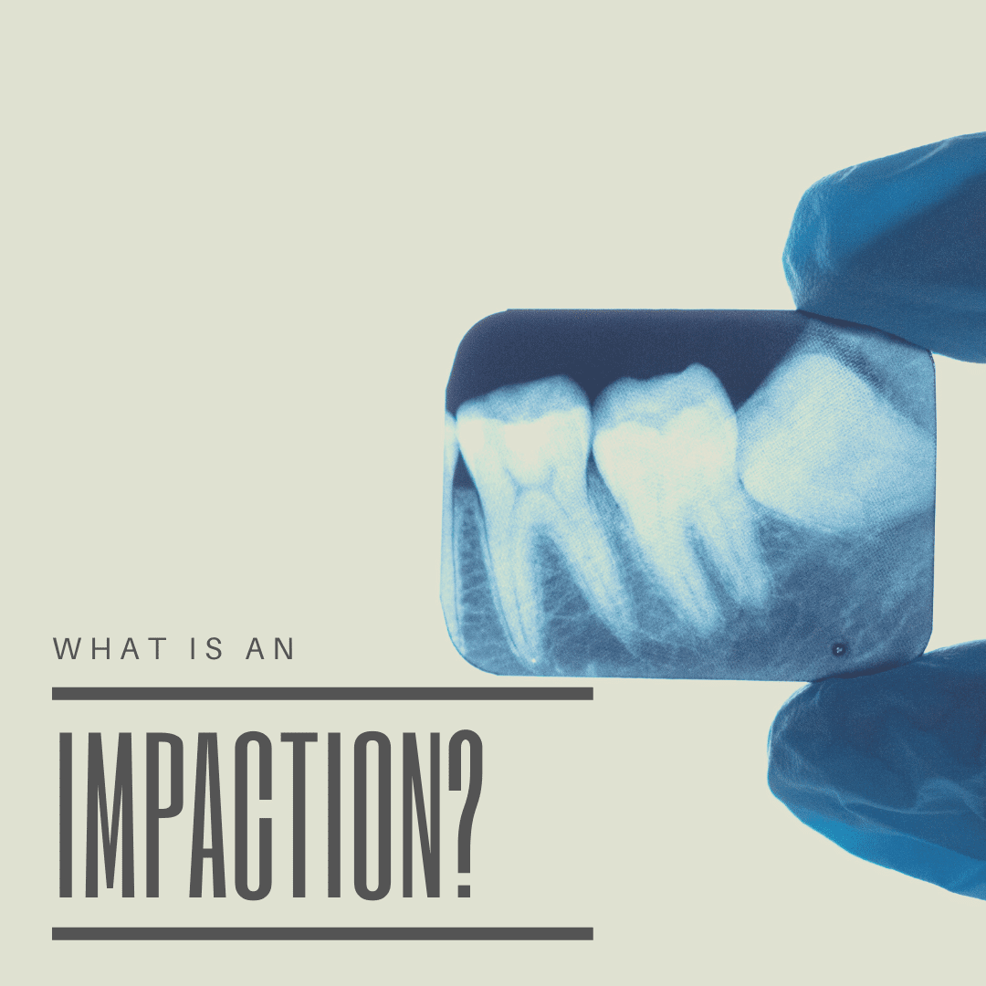 What is an Impaction? Empire Dental