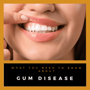 what you need to know about gum disease