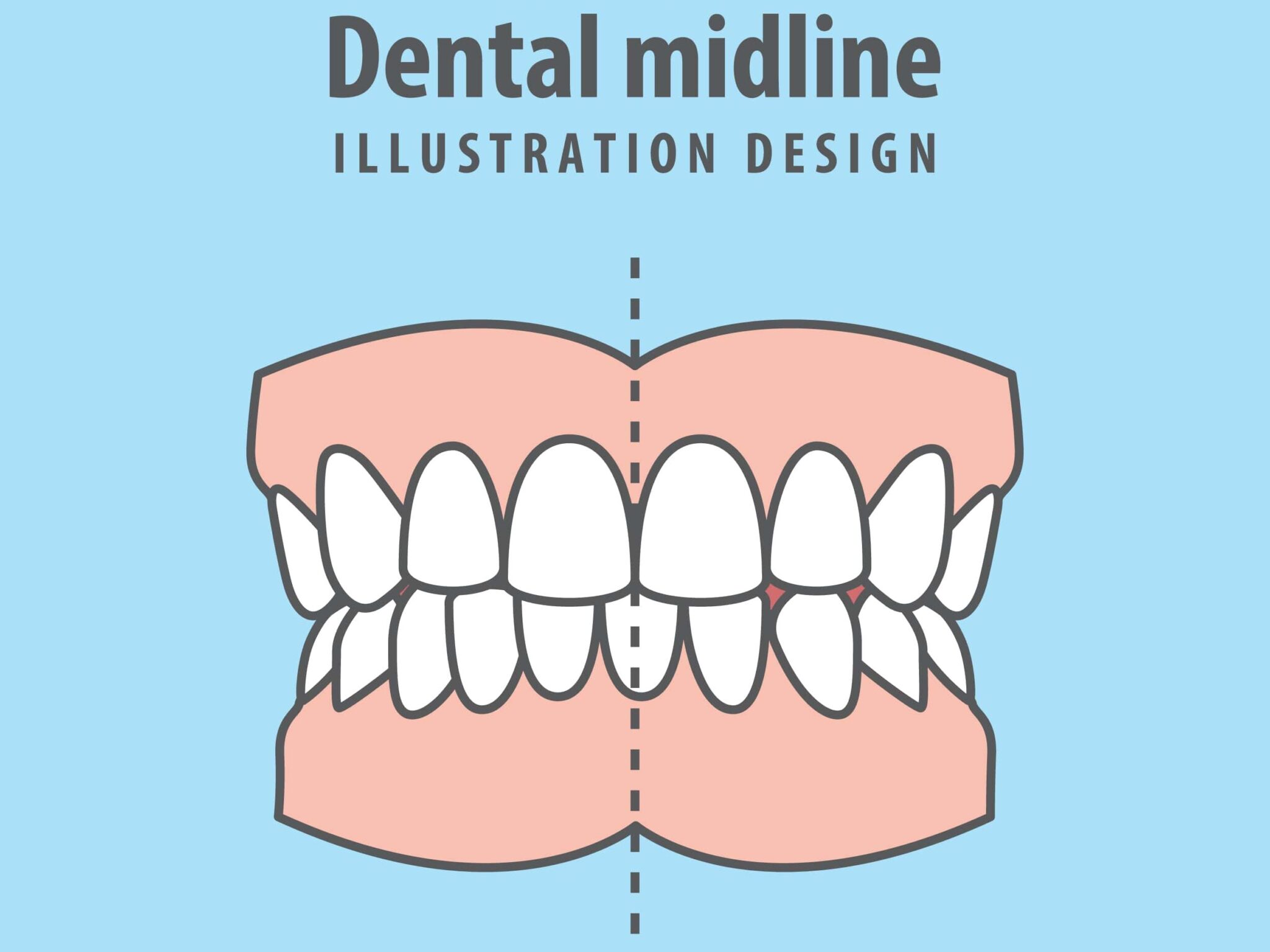 Dental midline