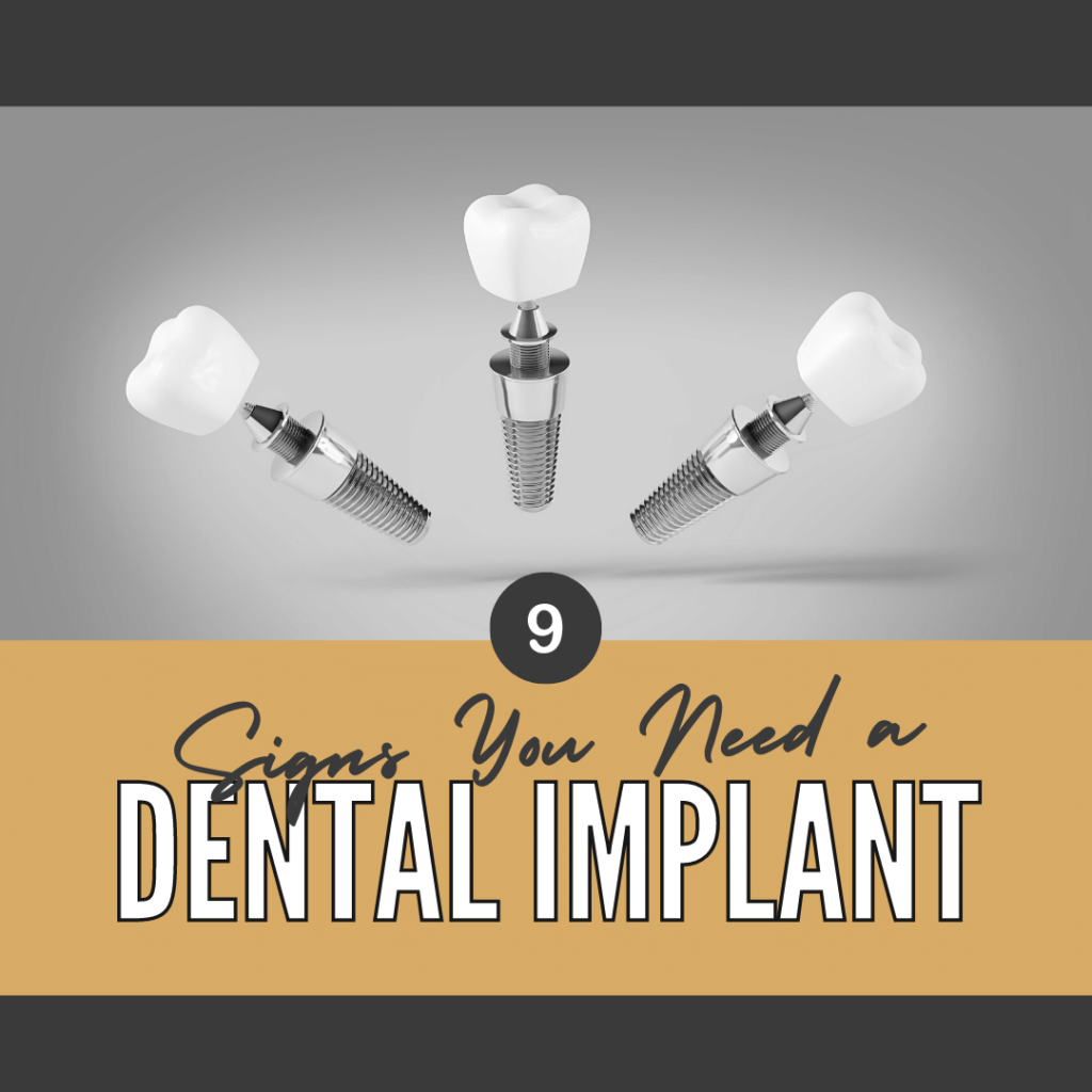 Signs You Need a Dental Implant