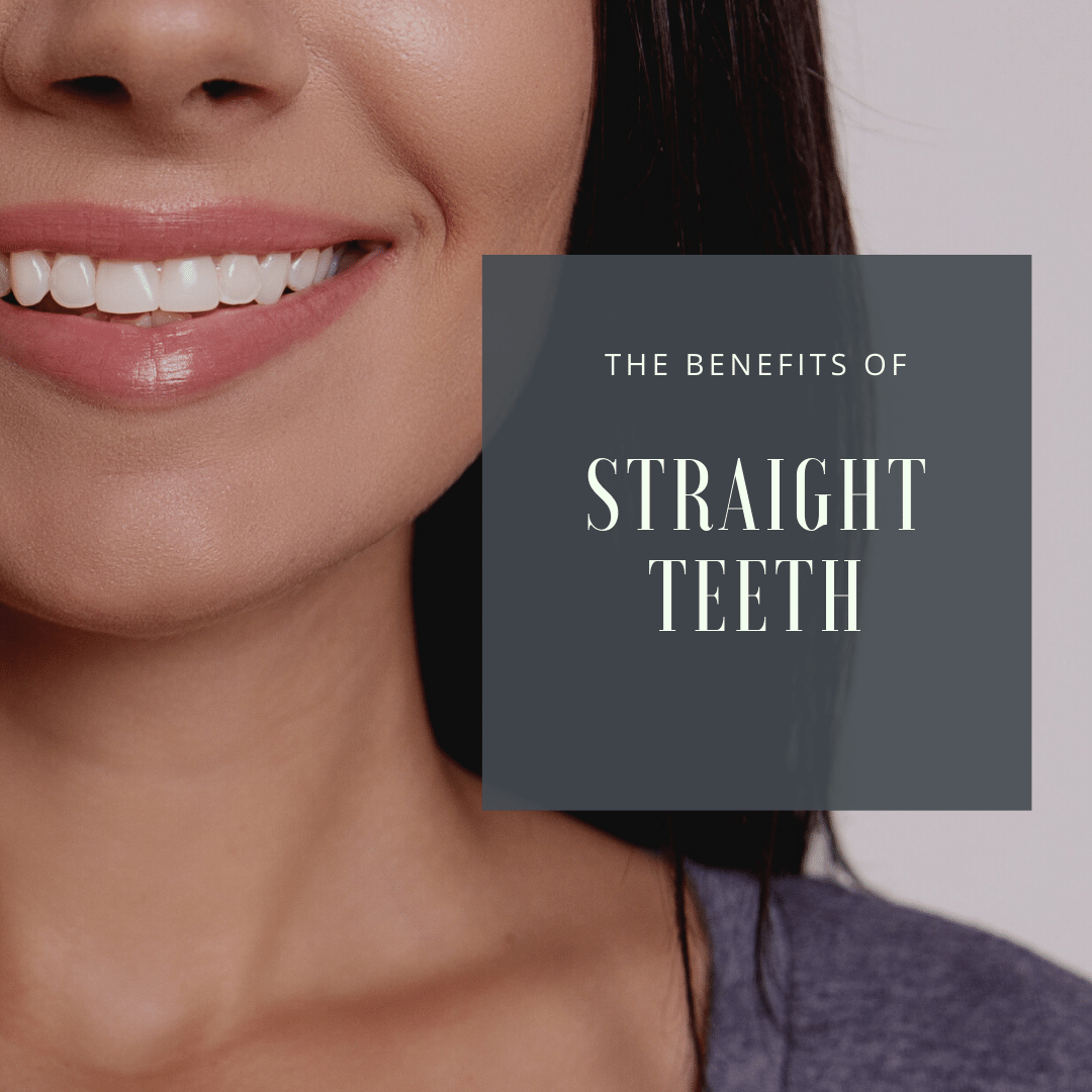 The Importance of Straight Teeth