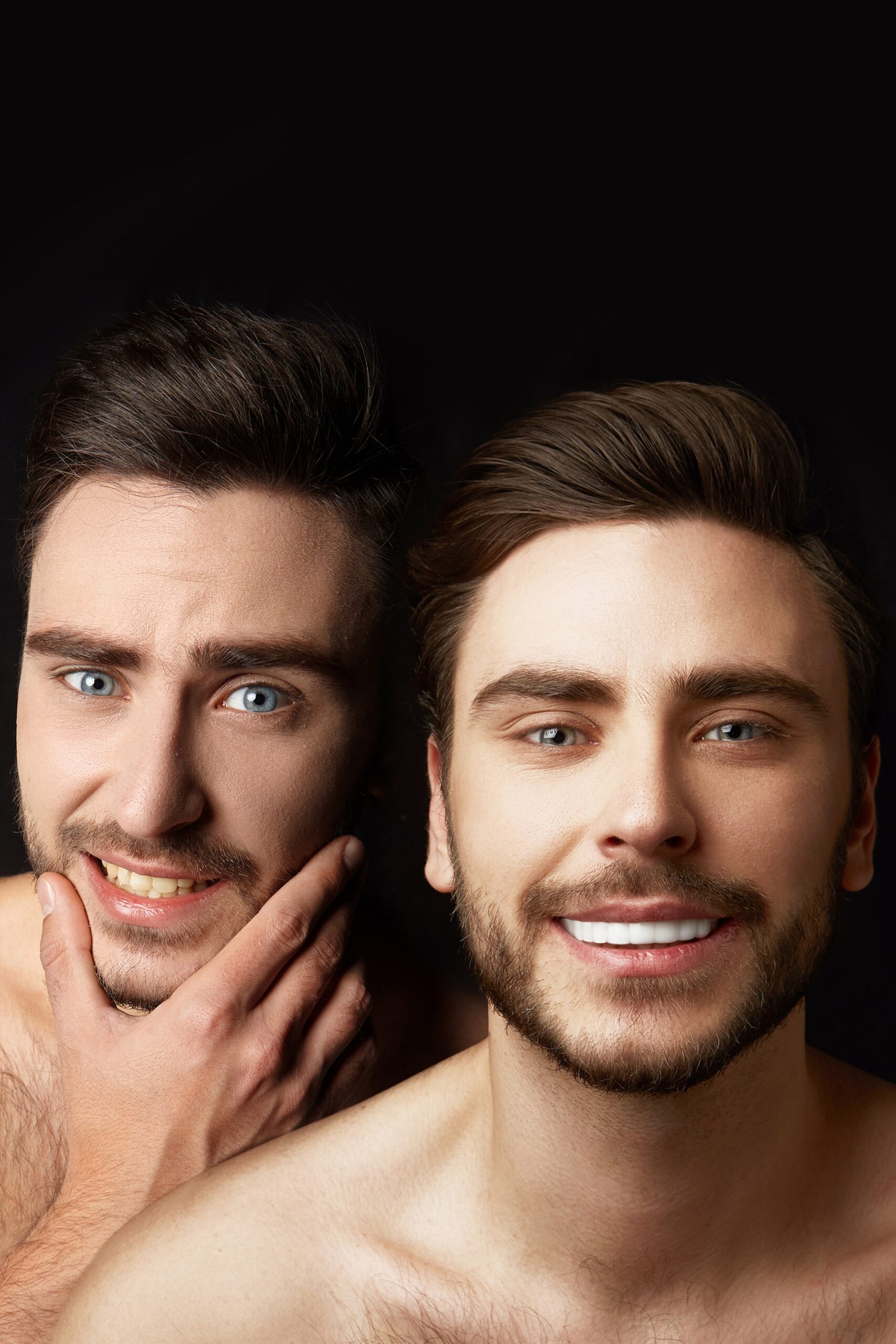 5 Things to Know Before Getting Veneers Empire Dental